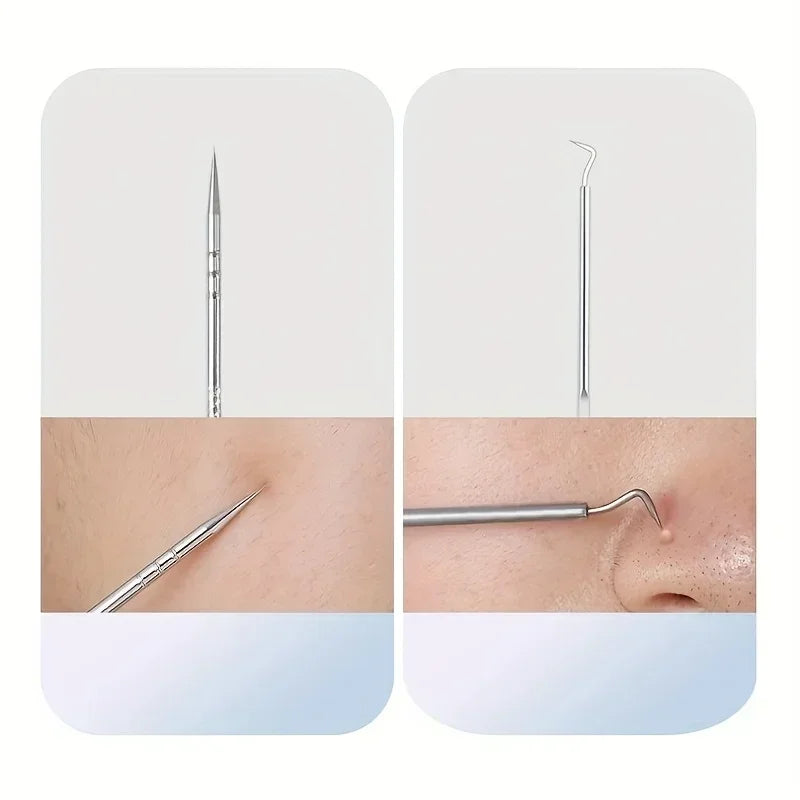 Stainless Steel Blackhead Remover Tool Set For Skincare Grooming Accessories