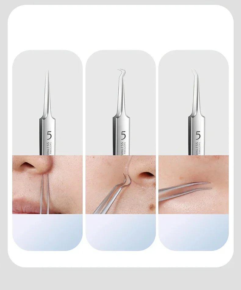 Stainless Steel Blackhead Remover Tool Set For Skincare Grooming Accessories